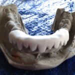 sculpting the teeth grill